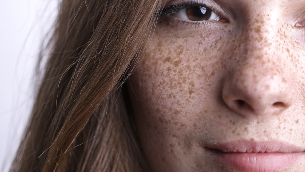 Girl with freckles